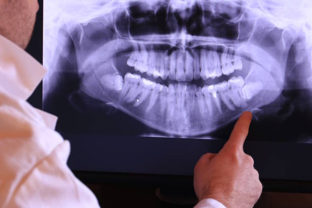 Best Broken or Cracked Tooth Emergency Dentist in Gladeville, TN