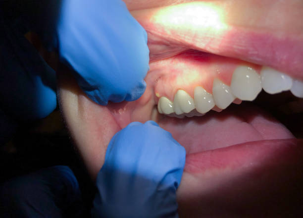 Best Mobile Emergency Dentist in Gladeville, TN