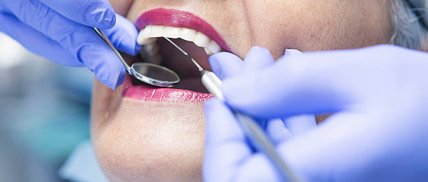 Best Emergency Dentist for Lost Fillings or Crowns in Gladeville, TN
